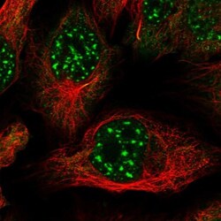 ZNF584 Antibody, Novus Biologicals:Antibodies:Primary Antibodies